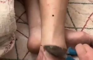 女猪仔在缅甸缅北园区被极度刑法老虎钳震脚腕骨视频